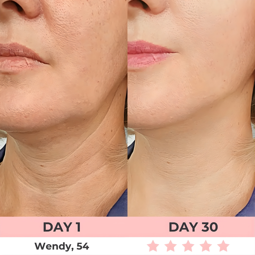 HEALORA 7-in-1 LED Facial Sculptor