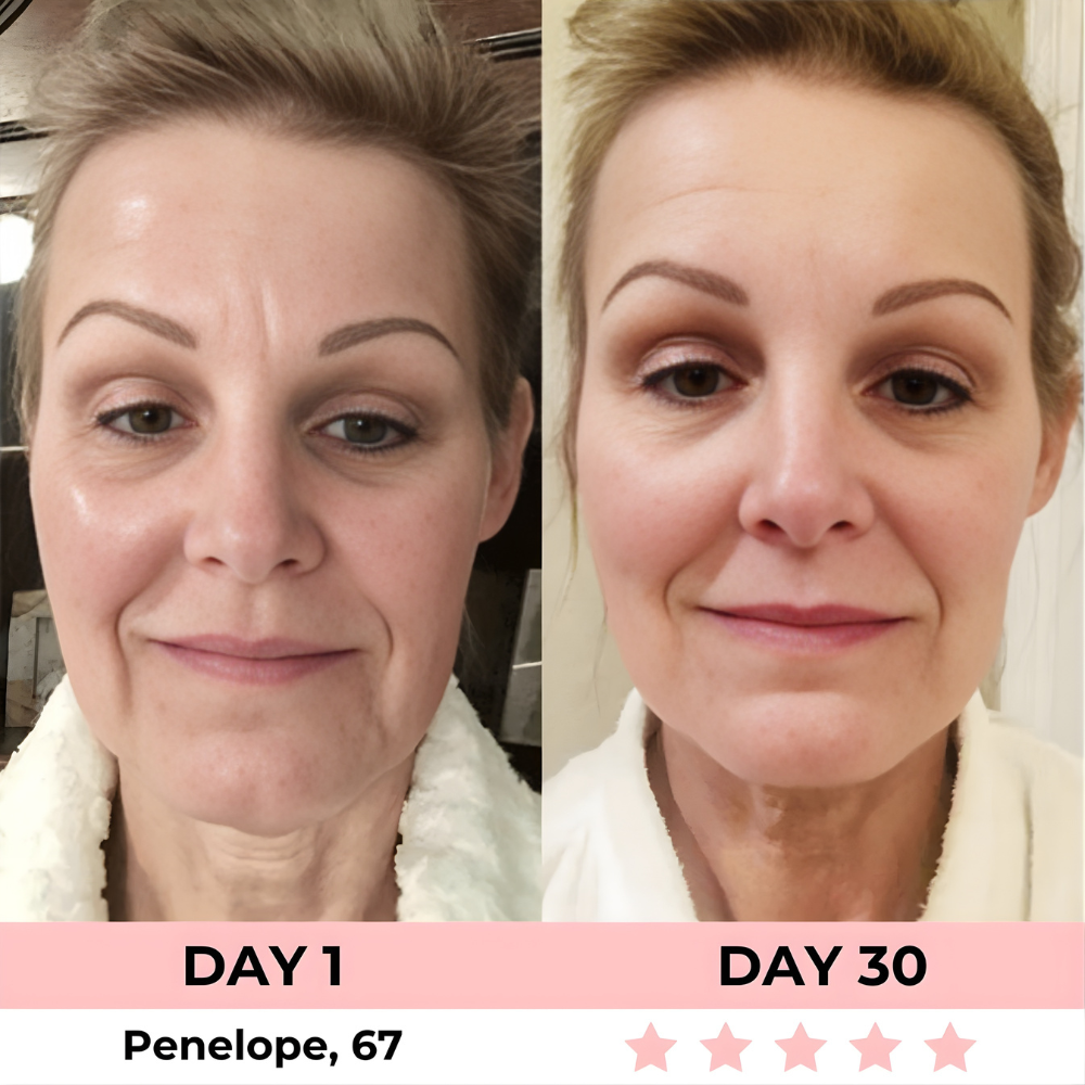 HEALORA 7-in-1 LED Facial Sculptor