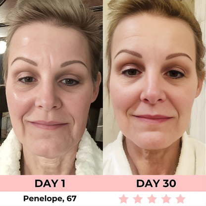 HEALORA 7-in-1 LED Facial Sculptor