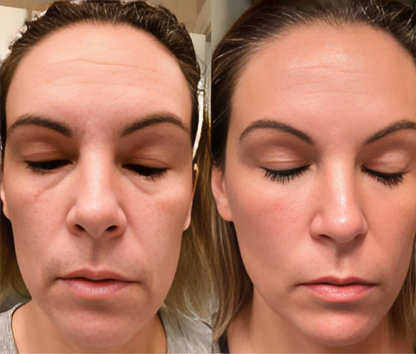 HEALORA 7-in-1 LED Facial Sculptor