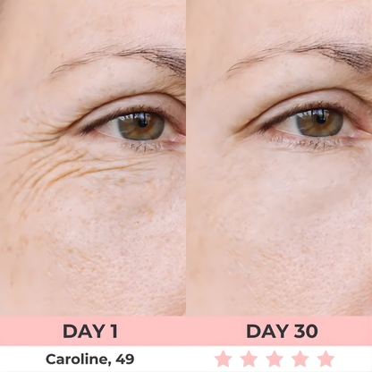 HEALORA 7-in-1 LED Facial Sculptor