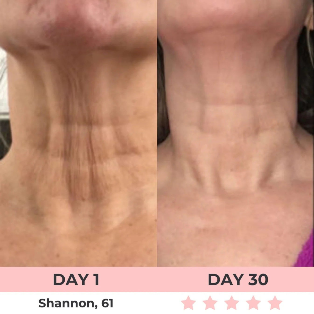 HEALORA 7-in-1 LED Facial Sculptor