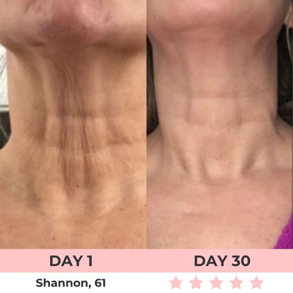 HEALORA 7-in-1 LED Facial Sculptor