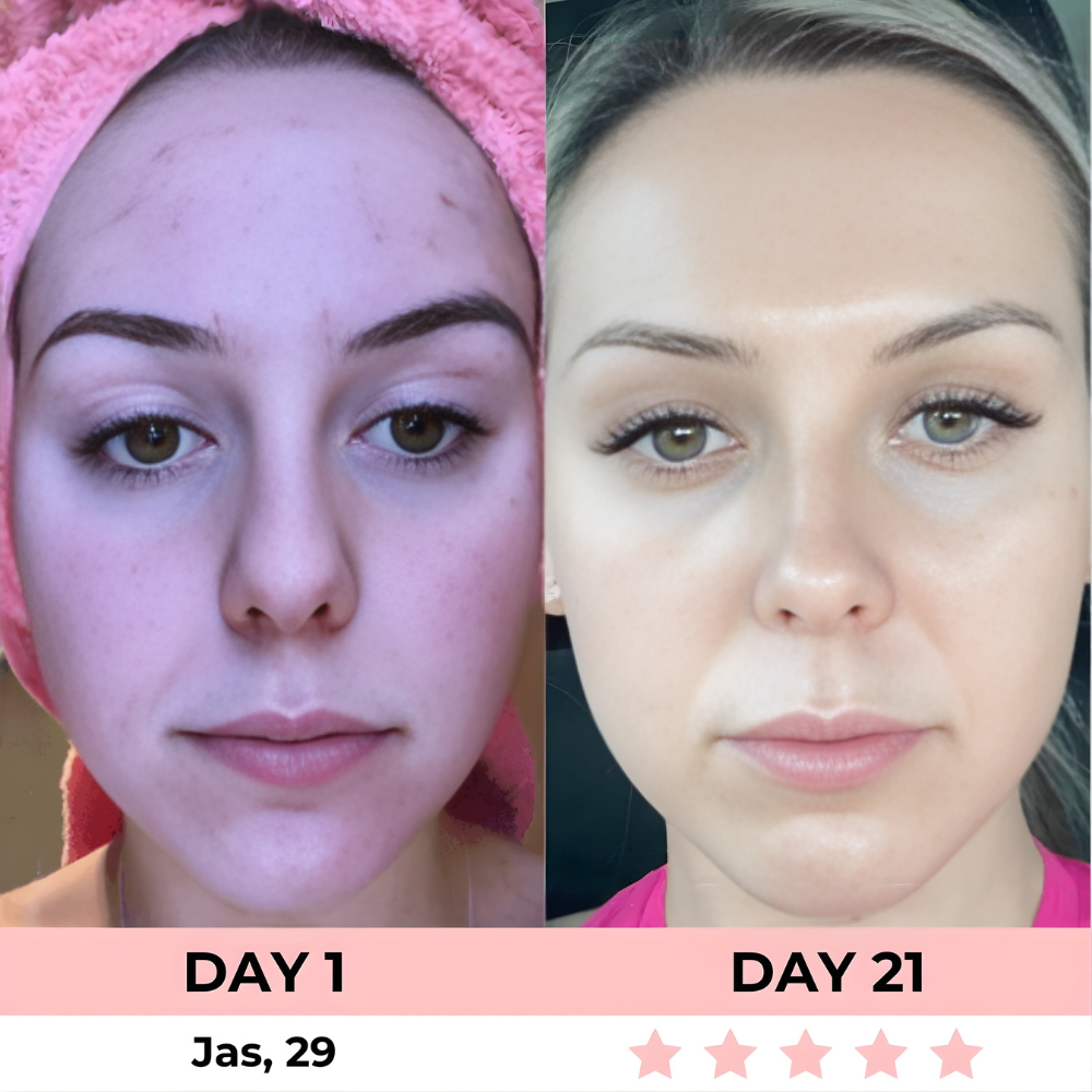 HEALORA 7-in-1 LED Facial Sculptor