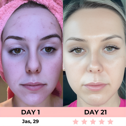 HEALORA 7-in-1 LED Facial Sculptor