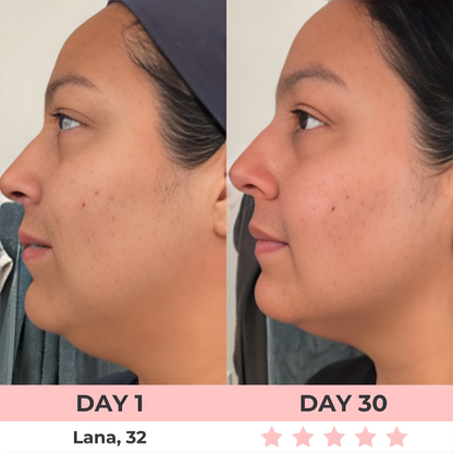 HEALORA 7-in-1 LED Facial Sculptor