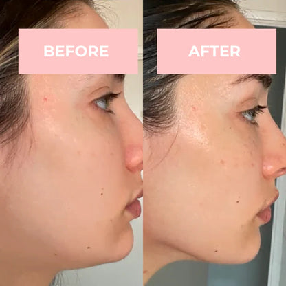 4-in-1 High Frequency Wand